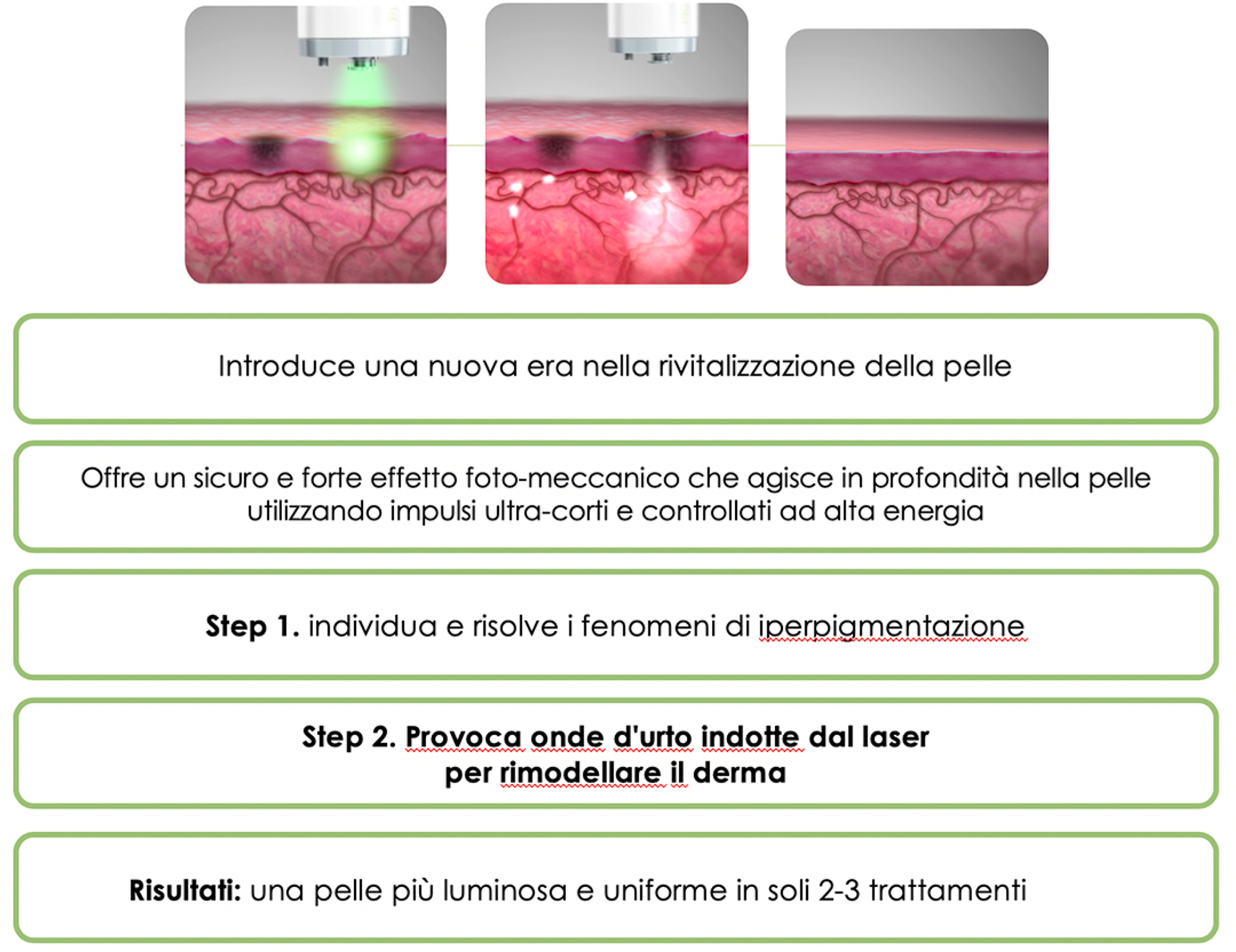 Laser_PICO_GENESIS_FX_Catania_rughe_viso Laser PICO GENESIS FX efficacia
