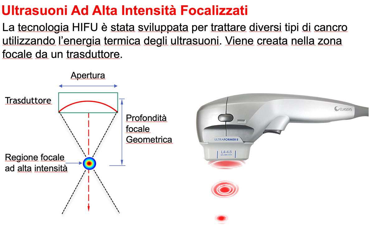 MFHIFU(Multi-Functional High Intensity Focused Ultrasound) Sistema non chirurgico di lifting e rassodamento di viso e corpo