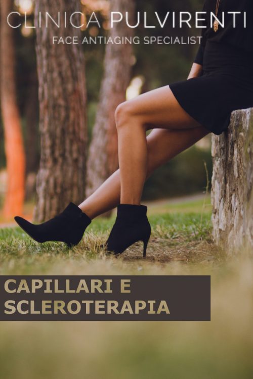 Scleroterapia catania