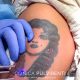 rimozione_laser_tatuaggio_catania